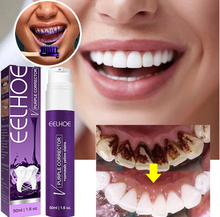 WHITENING TOOTHPASTE-50ml